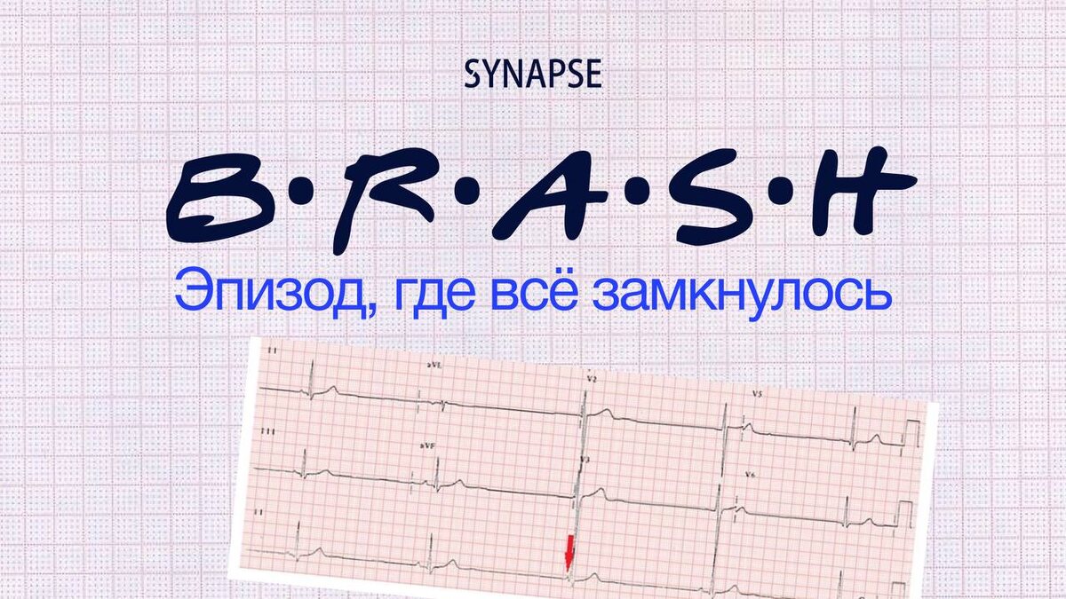Что такое BRASH-синдром и как его распознать
